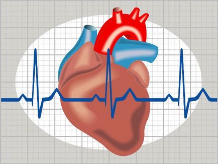 Fibrilația atrială a inimii - cauze și simptome, tratamentul este conservator și operativ