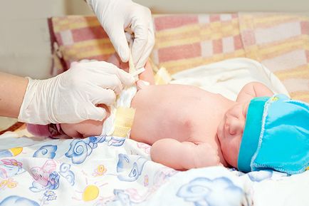 Manipularea ombilicului nou-născutului ce trebuie să știe mamele