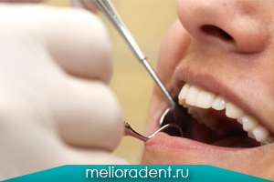 Gum plastica chirurgie în clinica dentară, prețul operațiunii