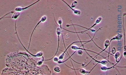 Miért vastag sperma, a probléma a férfi és női terméketlenség és módszerek oldatuk