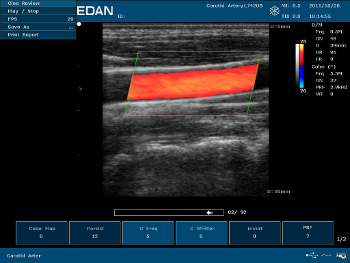 Портативний ультразвуковий сканер edan u50
