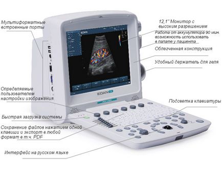 Scaner portabil cu ultrasunete edan u50