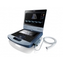 Hordozható ultrahang szkenner Edan acclarix AX8, egészségügyi szolgáltatás - ultrahangos szkennerek, ultrahanggal,