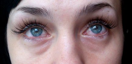 După extensiile genelor, ochii roșii, ce să facă