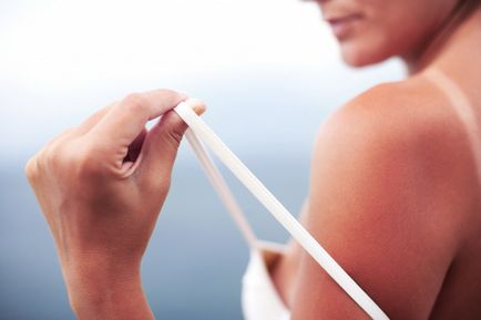 Роздратування шкіри від сонця як лікувати