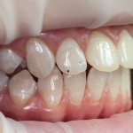 Dental Journal fogászati magazin (nyitó ízületi fej) Dental Journal fogászati magazin
