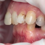 Dental Journal fogászati magazin (fogászati) Dental Journal fogászati magazin