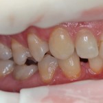 Dental Journal fogászati magazin (hónap funkcionális kezelés) Dental Journal fogászati magazin