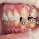 Dental Journal fogászati magazin (hónap funkcionális kezelés) Dental Journal fogászati magazin