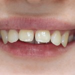 Dental Journal fogászati magazin (ízületi fej mozgása) Dental Journal fogászati magazin