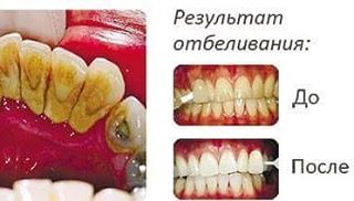 Стоматологія доктора Косневич - s photos in @dentistry_of_kosnevich instagram account