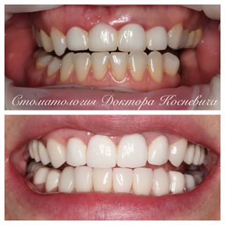 Stomatologia Dr. Kosnevich în fotografia @dentistry_of_kosnevich instagram