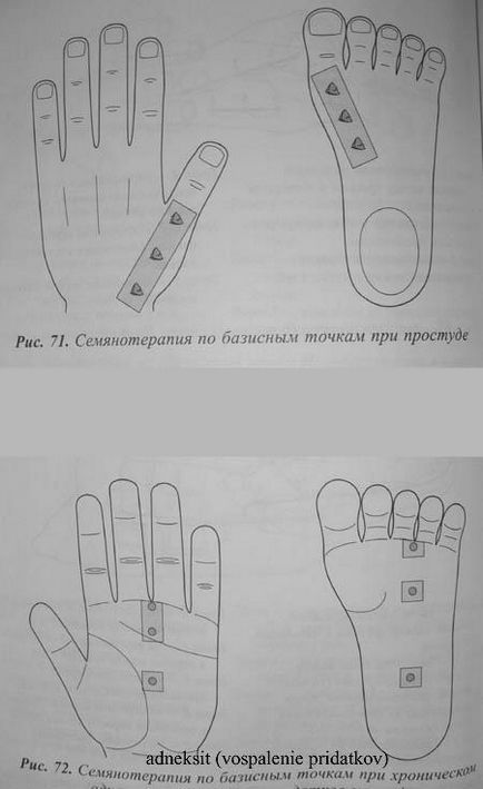 Су-джок семянотерапия по базисним точкам