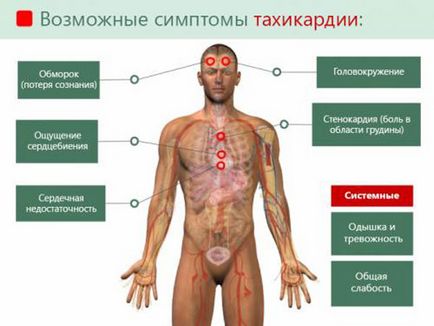 Тахікардія при ВСД - причини, симптоми, лікування, після їди, чи небезпечна, вранці