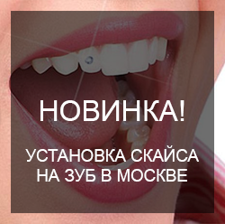 Mosolyogj, rsdent (örülök, hogy RSDENT) Mosolyogj, rsdent