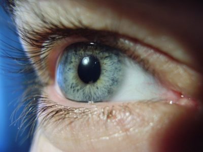 Uveitis szem tünetek és a kezelés, mi az, az oka a