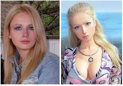 Valeria Lukyanova - chirurgie plastică, fotografie înainte și după chirurgia plastică