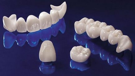 Tipuri de coroane dentare - caracteristicile coroanelor dentare