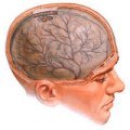 Водянка головного мозку лікування, симптоми і причини
