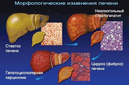 Анатомія і функції печінки, захворювання і їх симптоми