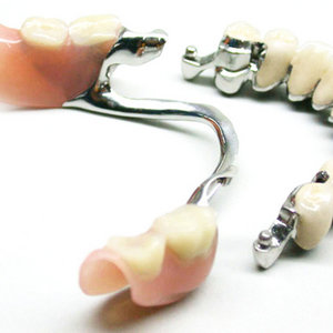 Atașați protezele dentare și dezavantajele