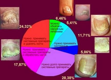 Cum de a construi o clasă maestră gel de unghii deteriorate de la un unghii mare