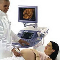 Sonografia pe calculator - ultrasunete pentru femeile gravide - 9 luni