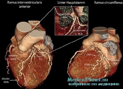 Tomografia computerizată Angiografia inimii (KTAG)