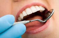 periodontitis kezelése népi jogorvoslat