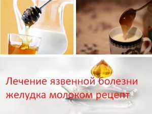 Лікування виразкової хвороби шлунка молоком рецепт