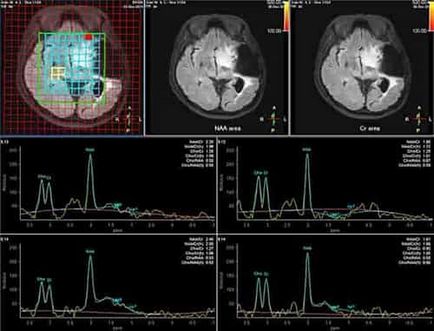 MRI диагностика да се направи в Москва цени, цената на магнитен изображения