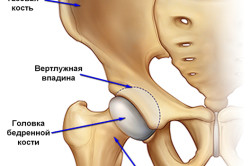 Fractura gâtului cauzată de șold, simptome, tratament și prim ajutor