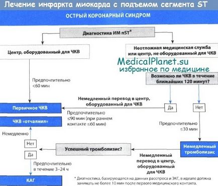 Принципи лікування неускладненого інфаркту міокарда