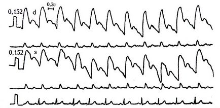 Regge (rheoencephalography) a vaselor cerebrale ceea ce este, decodarea, normele