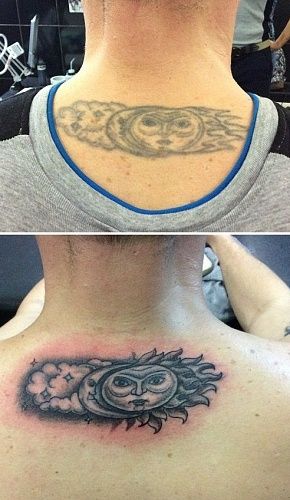 Restaurarea tatuajelor