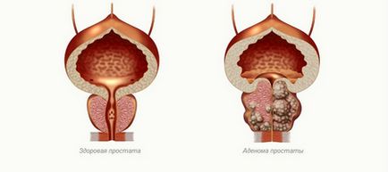 Cât durează un masaj de prostată al unui om