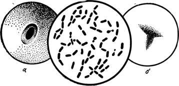 Agentul cauzal al gangrenei de gaz este microbiologia cu tehnica de studii microbiologice