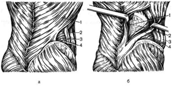 Anatomia chirurgicală a peretelui abdominal (partea 2)