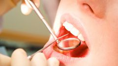 De ce eliminați dinții sănătoși - medicii recomandă dinții de înțelepciune pentru a fi îndepărtați în avans - sănătate și medicamente