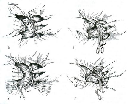 Allsurgery - leziuni ale splinei