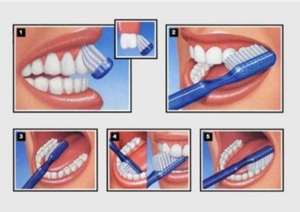 Renunță la fumat - gingiile sângerând au început să sângereze