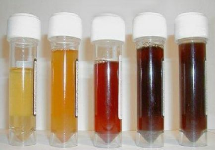 Culoarea urinei umane