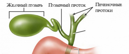 Дискінезія жовчного міхура що це таке, симптоми, лікування, ознаки