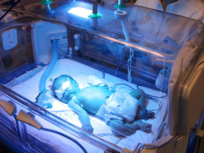 Ентеросгель для новонароджених від жовтяниці застосування, протипоказання і побічні ефекти