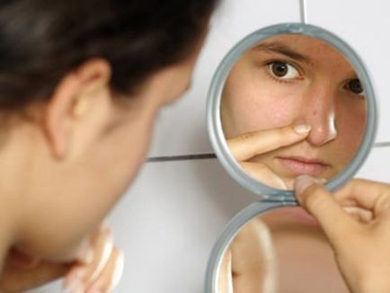 Cum să scapi de acnee pe tratamentul feței, cum să elimini acneea din față