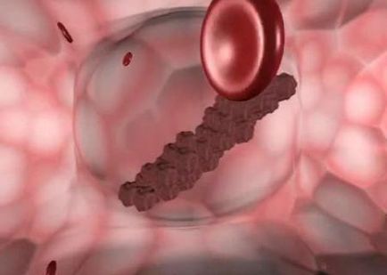 Cum de a proteja vasele de sânge de la formarea de trombi cinci sfaturi - știri despre sănătate - sănătatea femeilor și