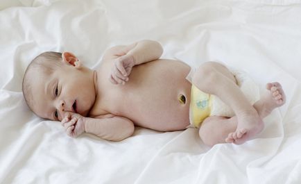 Coroana ombilicului nou-nascutului ce sa faca, de ce sangereaza in 2-3 saptamani