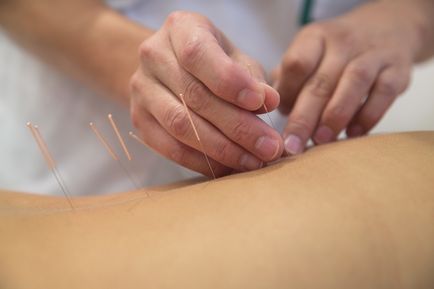 Tratamentul alcoolismului cu acupunctura