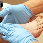 Tratamentul piciorului diabetic și a ulcerului trofic