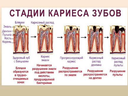 Microbiologie, Virologie și Imunologie a Boli Orale Odesa